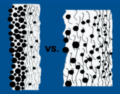Oberflächen- vs. Tiefenfiltration